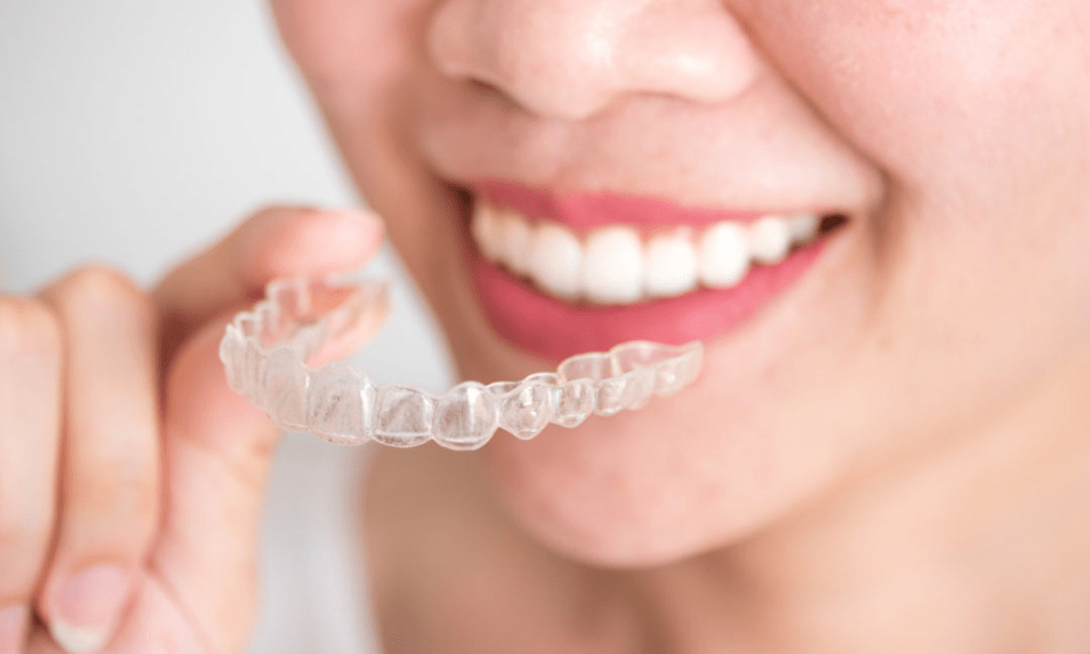 Invisalign